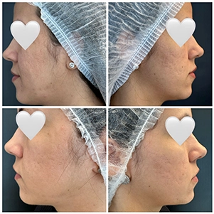 prova-social-laser-discovery-pico-04