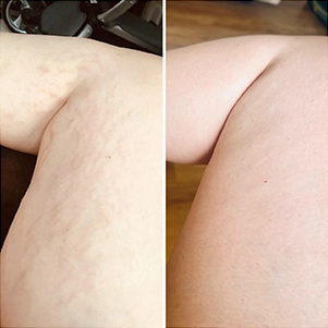 prova-social-ultraformer-mpt-05