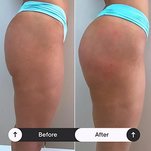 prova-social-ultraformer-mpt-09